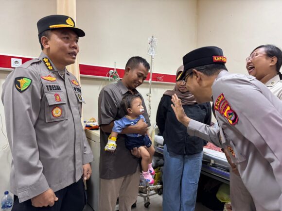Sambut Hari Bhayangkara ke-79, Polda NTB Gelar Operasi Katarak dan Bibir Sumbing Gratis di RS Bhayangkara