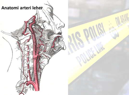 Diagnosis Diferensial Trauma Leher • Trauma tembus leher • Trauma tumpul pada leher o Diseksi arteri vertebralis dan karotis o Pencekikan o Cedera leher • Cedera serviks o Fraktur dan dislokasi serviks o Cedera serviks (anak-anak) o Pembersihan tulang belakang leher • Syok neurogenik • Cedera sumsum tulang belakang